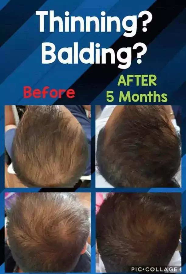 MONAT - Товары для здоровья в Сан-Диего