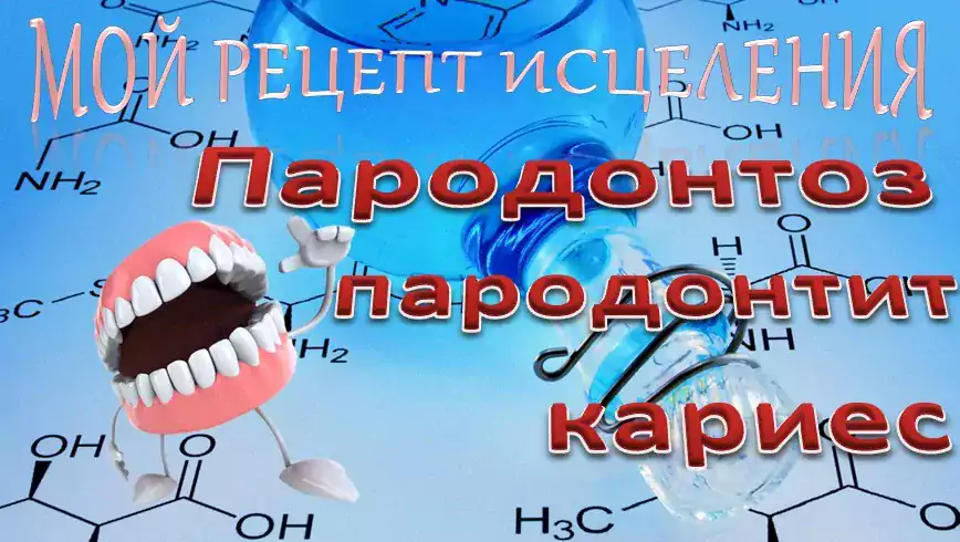 Пародонтоз – уникальный метод исцеления - Онлайн-продажи в Хьюстоне