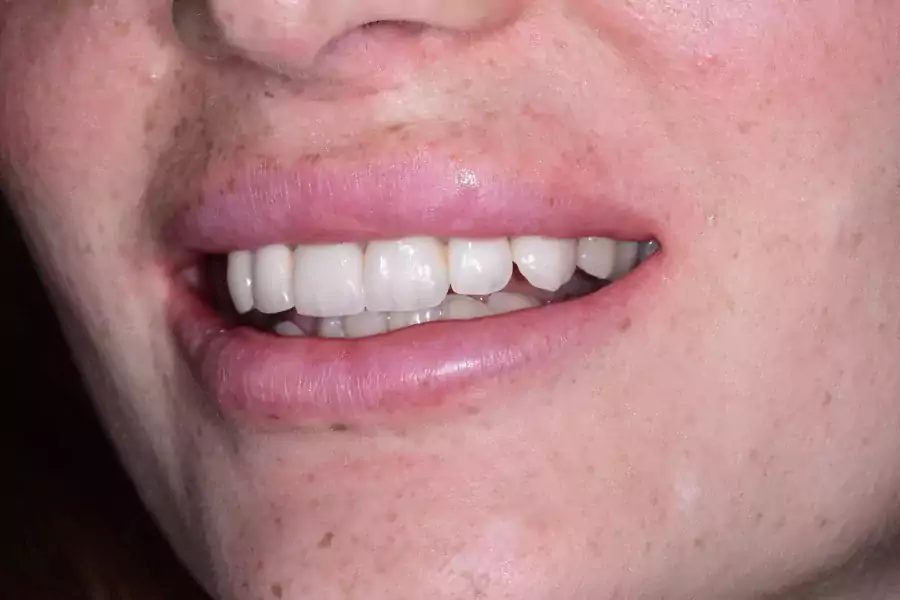 Fenix DentalLab - Стоматологи в Лос-Анджелесе