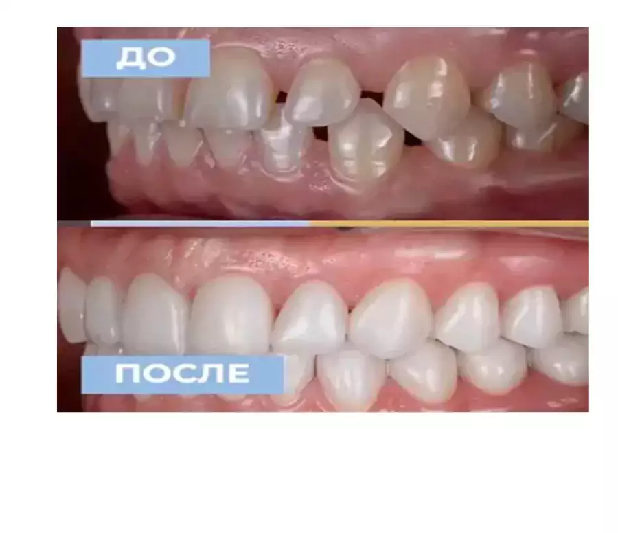 Dr. Sidiropylo Feona — СОВРЕМЕННАЯ ЭСТЕТИЧЕСКАЯ СТОМАТОЛОГИЯ! - Стоматологи в Лос-Анджелесе